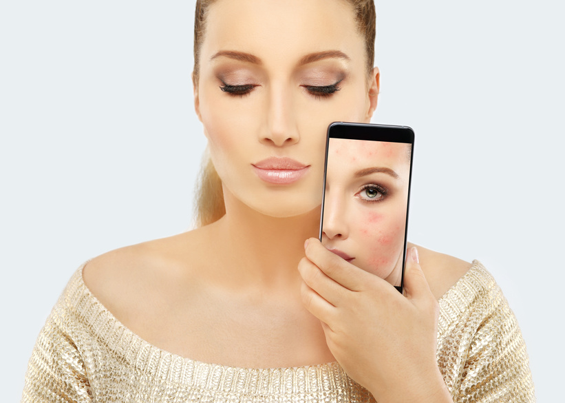 vanity soin peeling acné