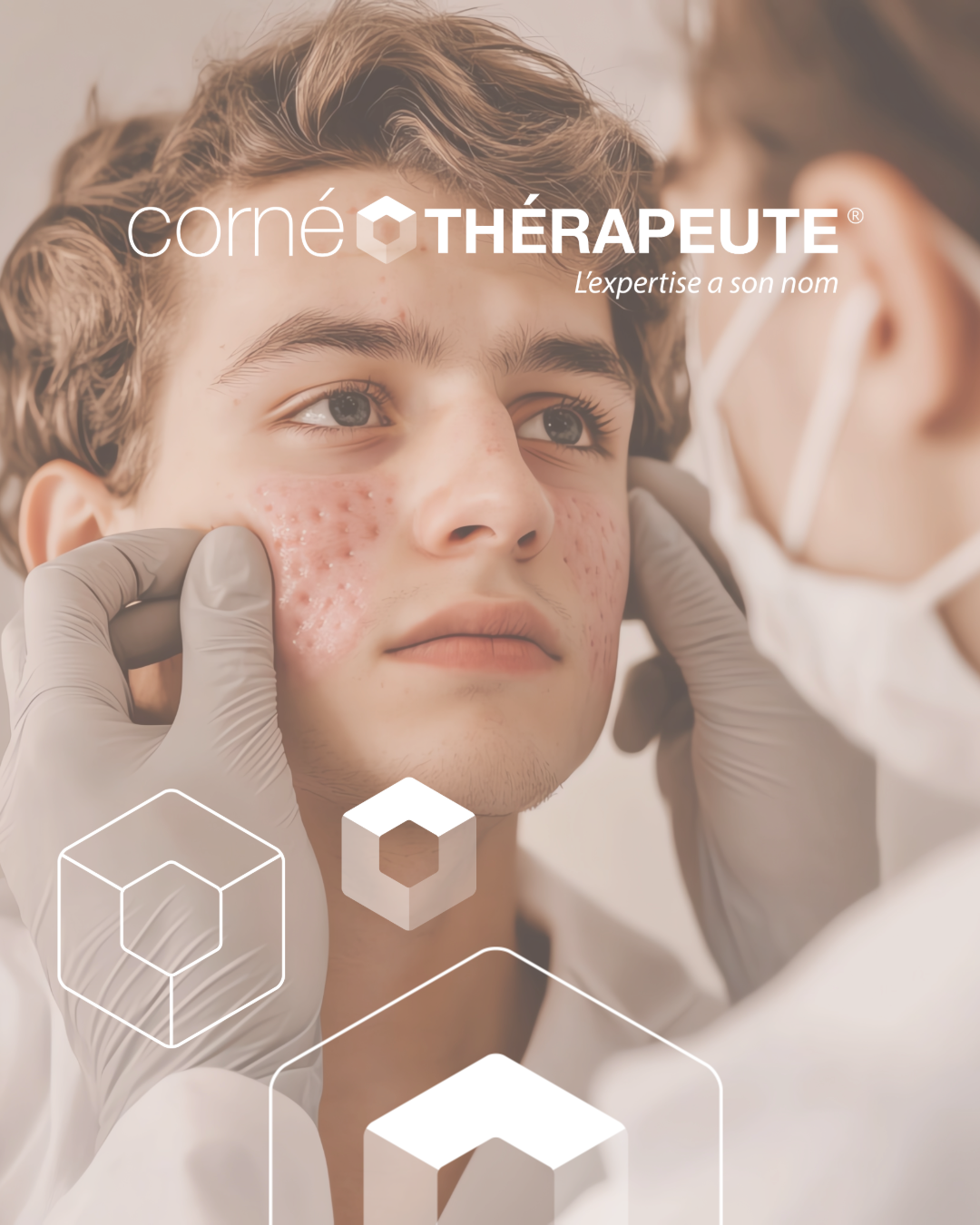 nettoyage de peau Yvelines 