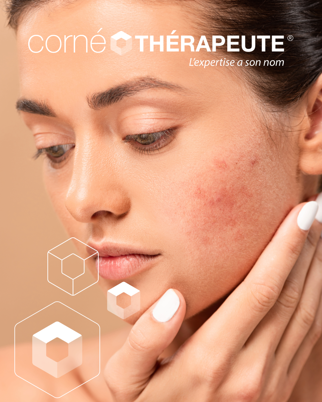 Nettoyage de peau Yvelines